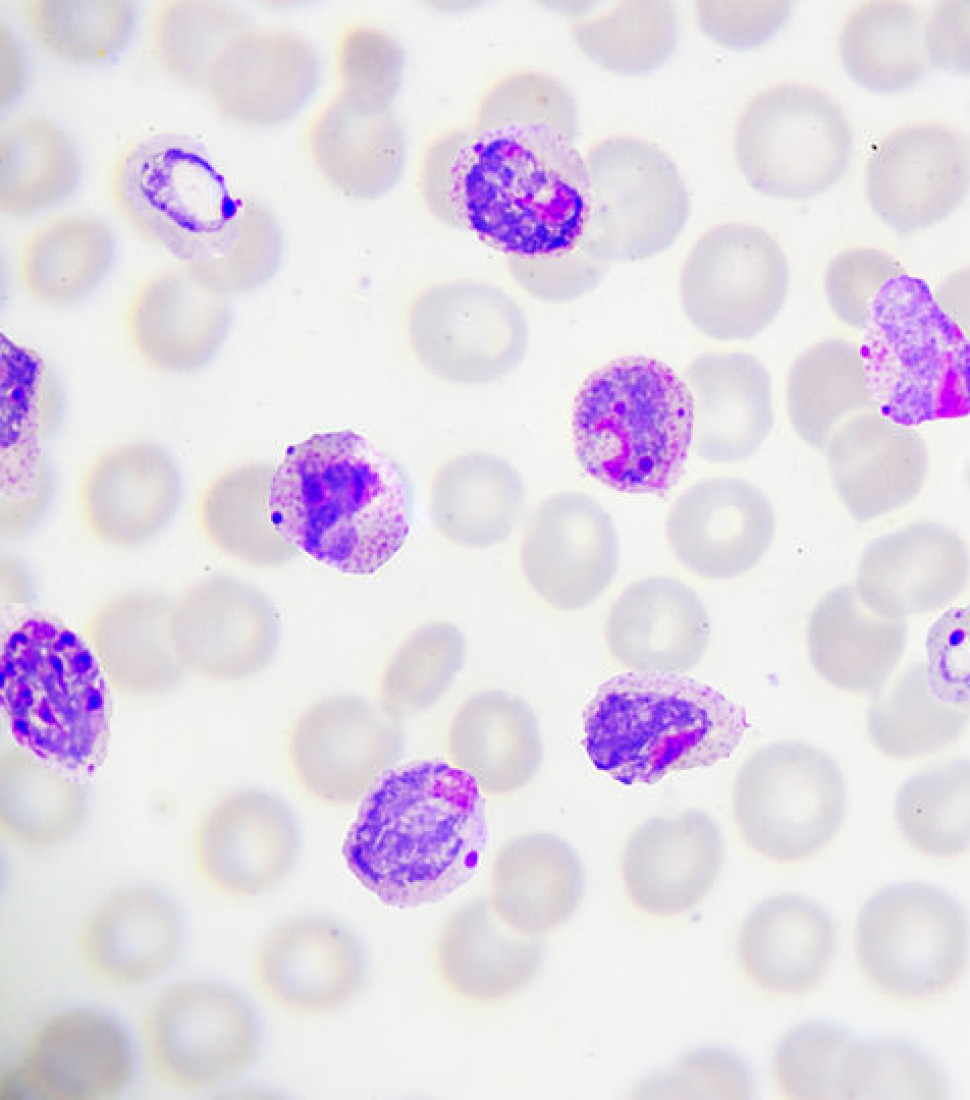 whatismalaria_malaria_parasite_585